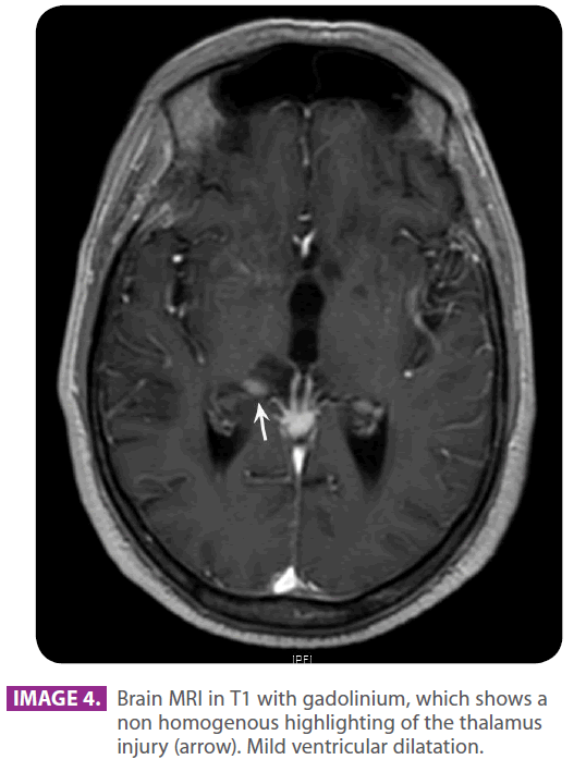 jneuro-homogenous-highlighting