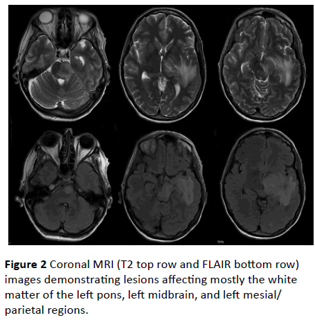 jneuro-images-demonstrating-lesions