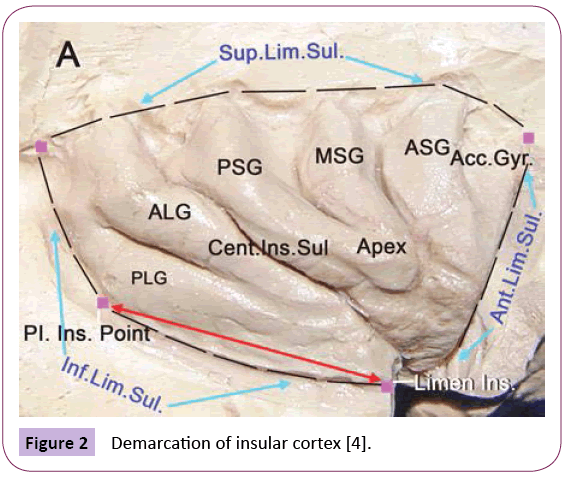 jneuro-insular-cortex