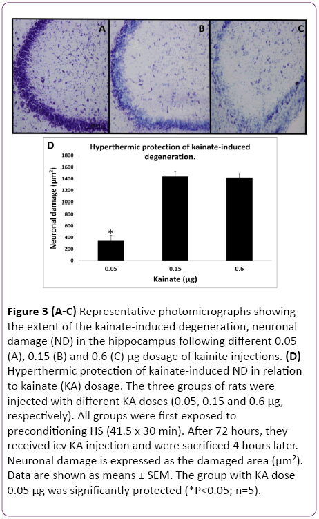 jneuro-kainate-induced