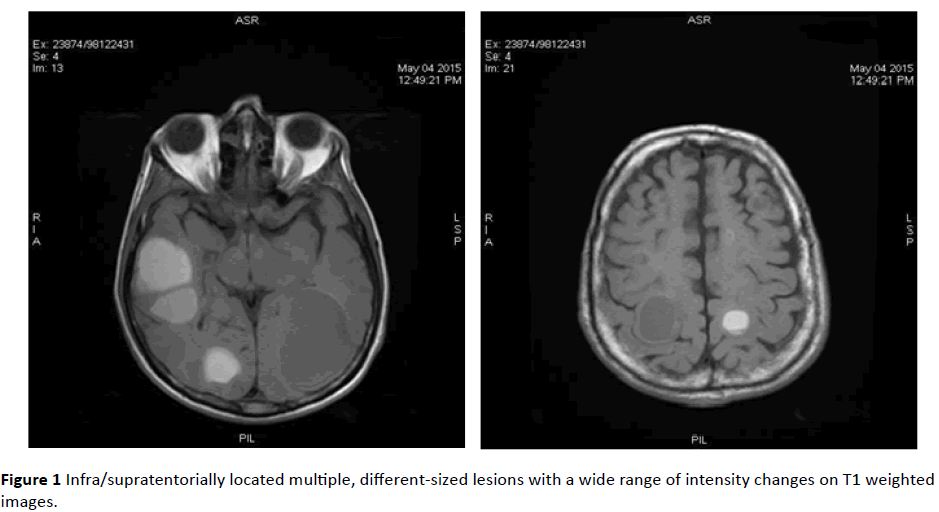 jneuro-located-multiple