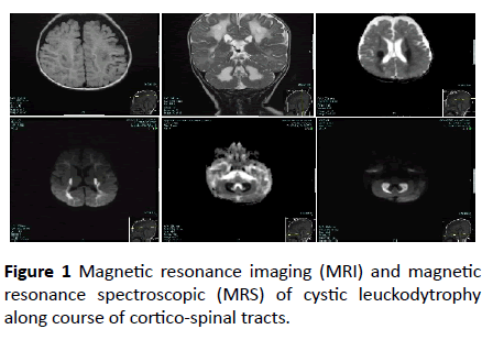 jneuro-magnetic-resonance