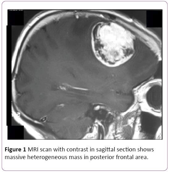 jneuro-massive-heterogeneous-mass