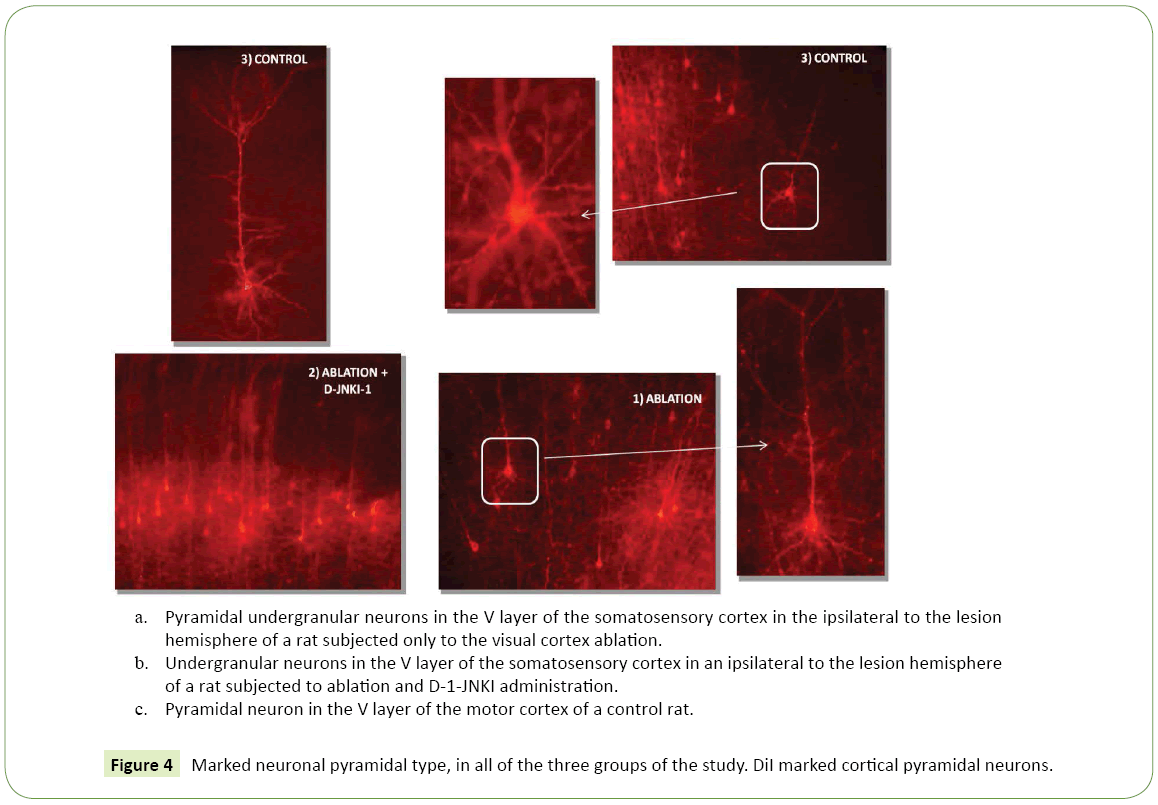 jneuro-neuronal-pyramidal