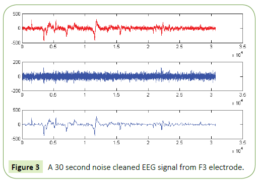 jneuro-noise-cleaned-EEG-signal