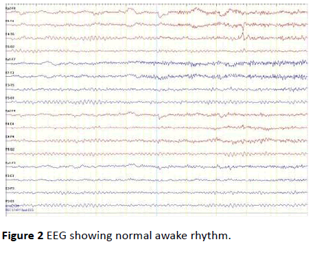 jneuro-normal-awake-rhythm