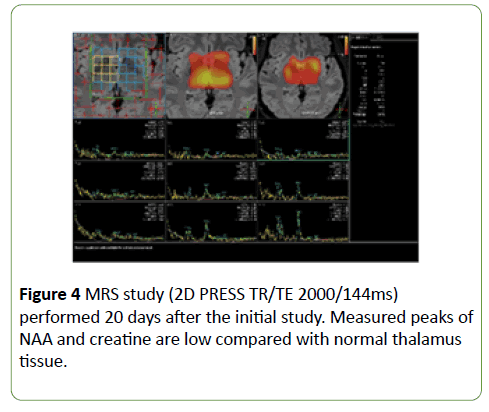 jneuro-normal-thalamus