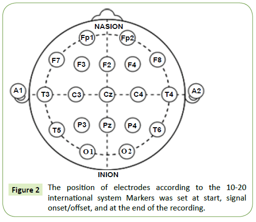 jneuro-position-electrodes-according