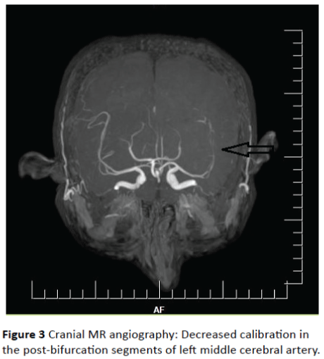 jneuro-post-bifurcation