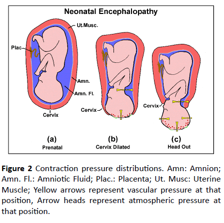 jneuro-pressure-distributions