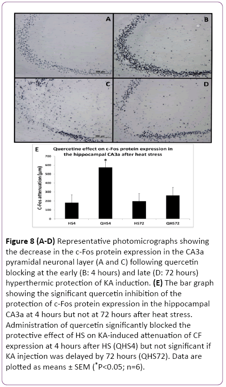 jneuro-protein-expression