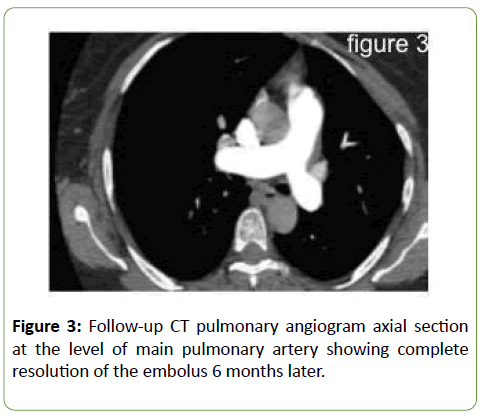 jneuro-pulmonary