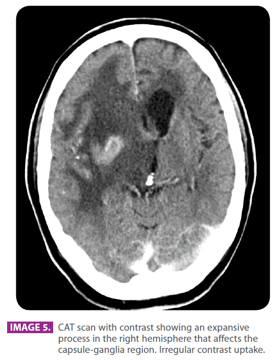 jneuro-right-hemisphere