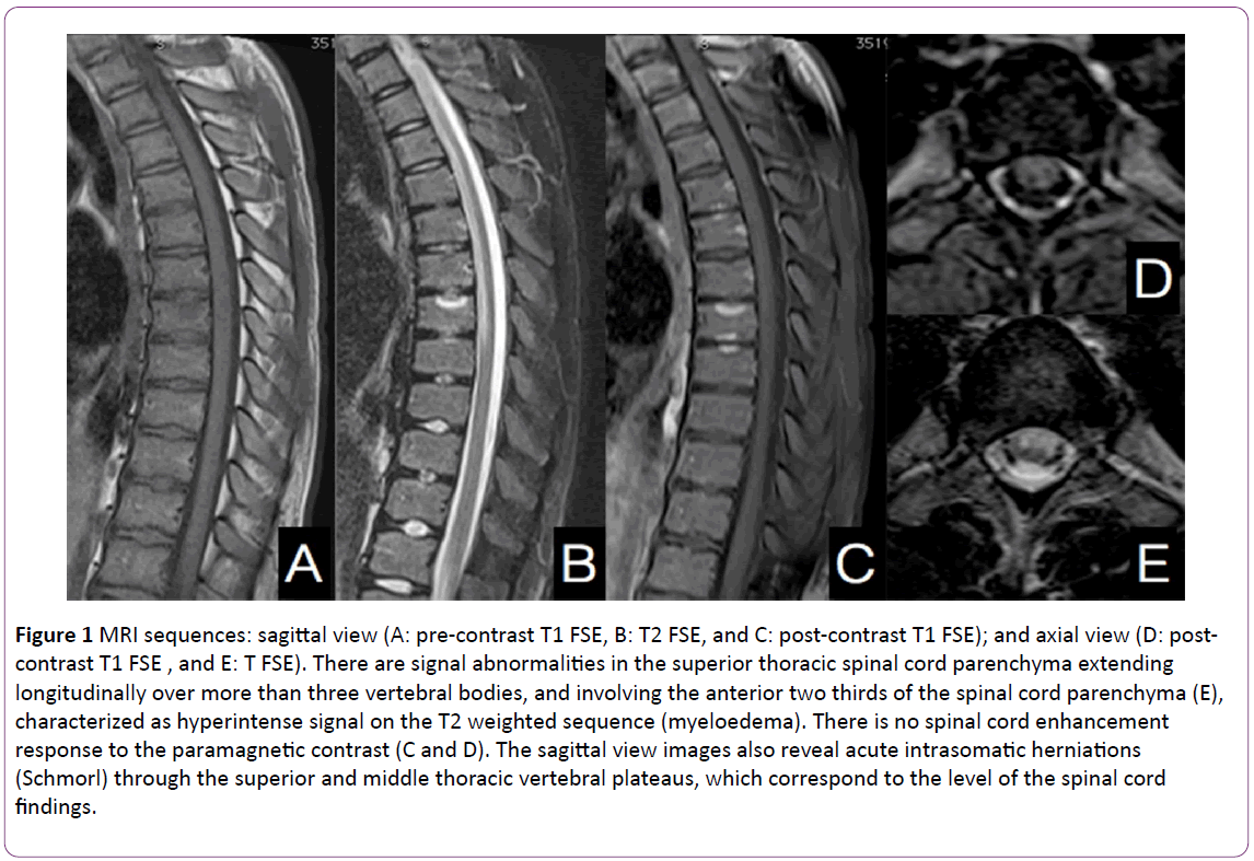 jneuro-sagittal-axial-signal