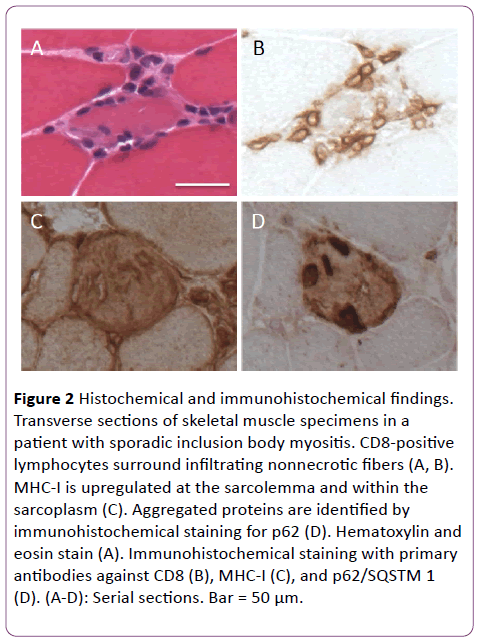 jneuro-skeletal-muscle