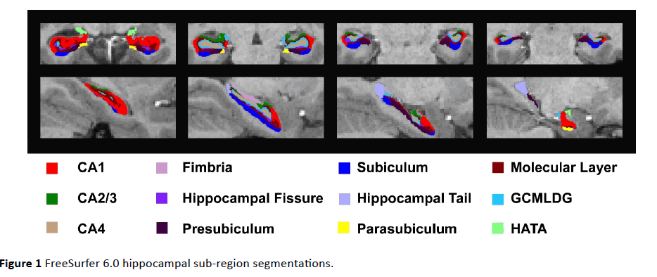 jneuro-sub-region-segmentations