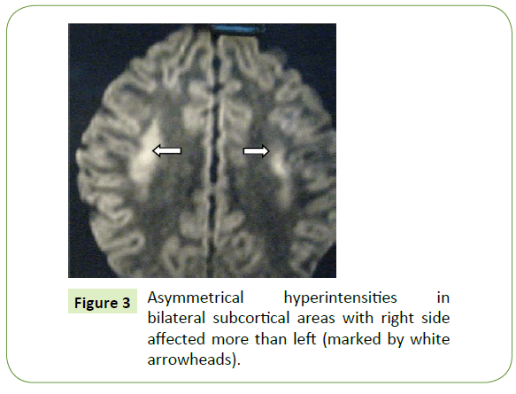 jneuro-subcortical-areas