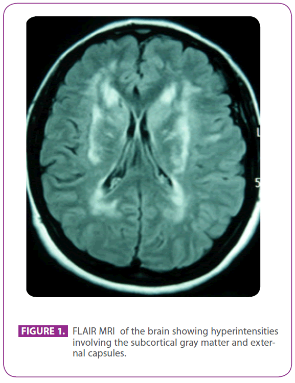 jnuero-subcortical-gray-matter