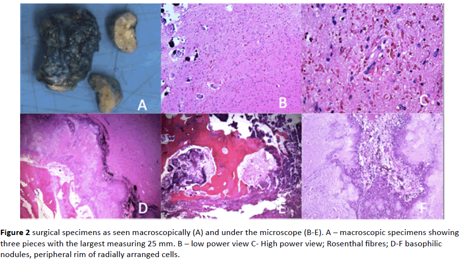 surgical-specimens-macroscopically