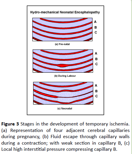 jneuro-temporary-ischemia