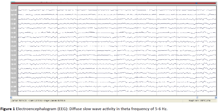 jneuro-pre-treatment