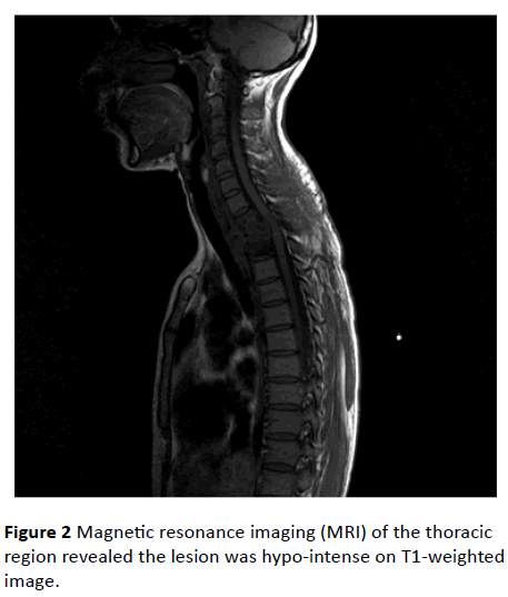 jneuro-thoracic-region