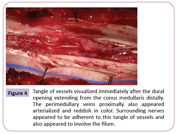 jneuro-vessels-visualized