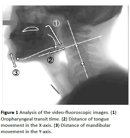 jneuro-video-fluoroscopic-images