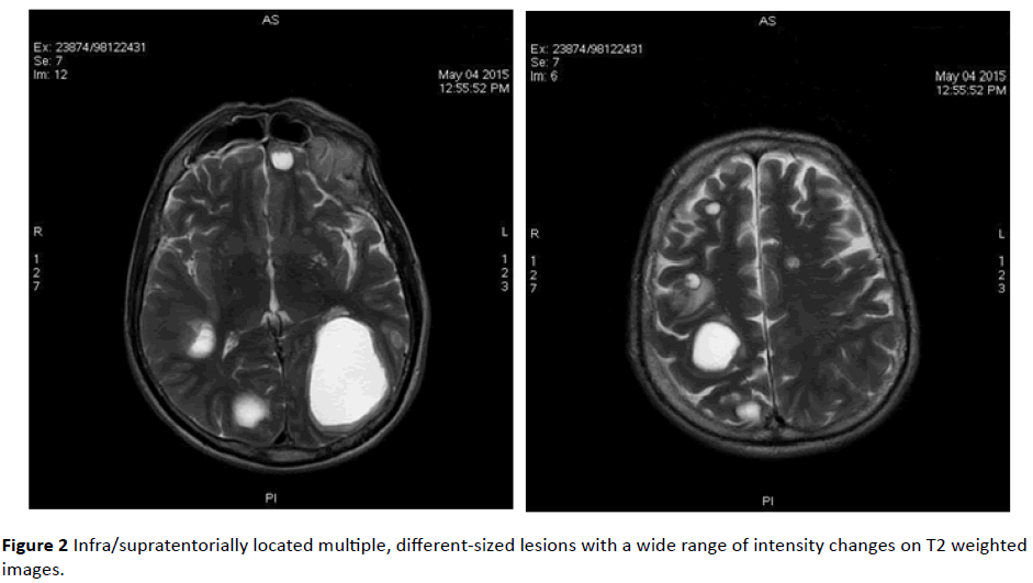 jneuro-weighted-images