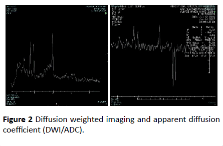 jneuro-weighted-imaging