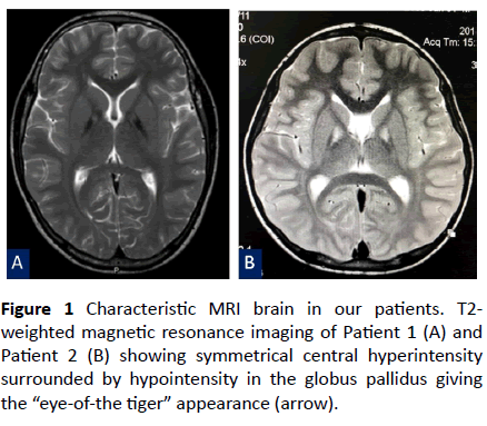 jneuro-weighted-magnetic