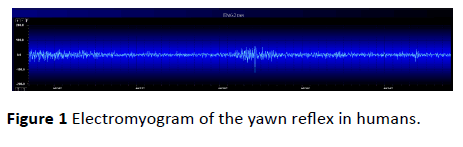jneuro-yawn-reflex-humans