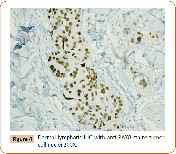 jusurgery-Dermal-lymphatic