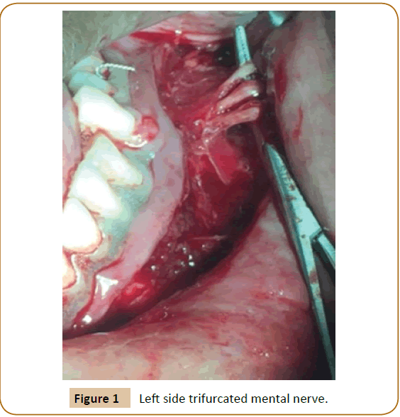 jusurgery-Left-side