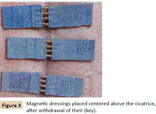 jusurgery-Magnetic-dressings