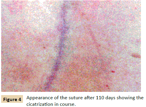 jusurgery-Magnetic-dressings