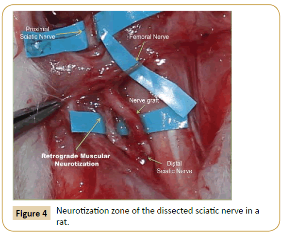 jusurgery-Neurotization-zone