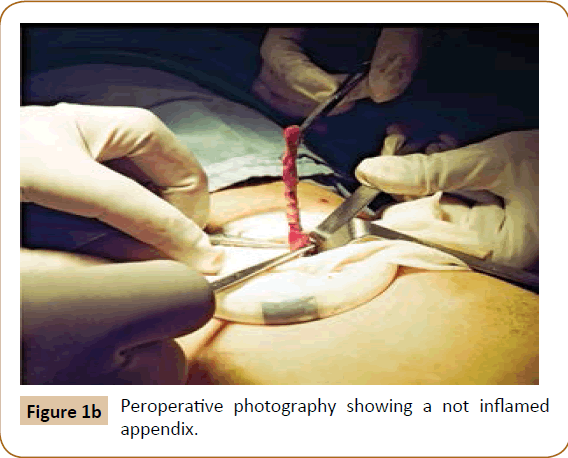 jusurgery-Peroperative-photography