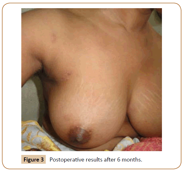 jusurgery-Postoperative-results