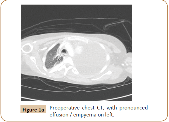 jusurgery-Preoperative-chest