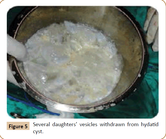 jusurgery-Several-daughters