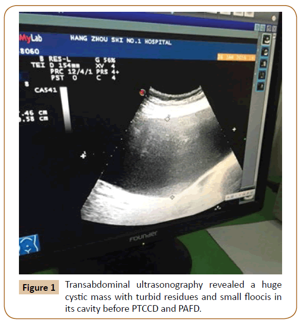 jusurgery-Transabdominal-ultrasonography