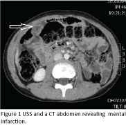 jusurgery-USS-and-CT