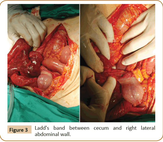 jusurgery-abdominal-wall