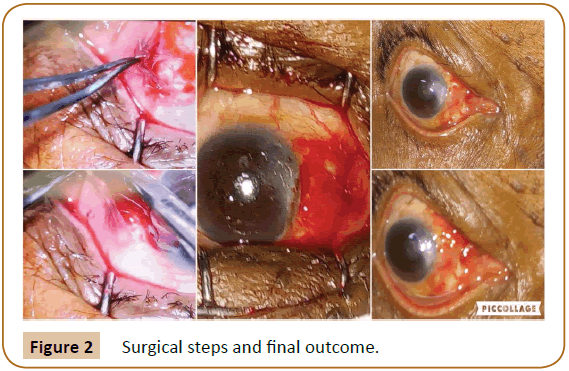 jusurgery-ages-Surgical-steps