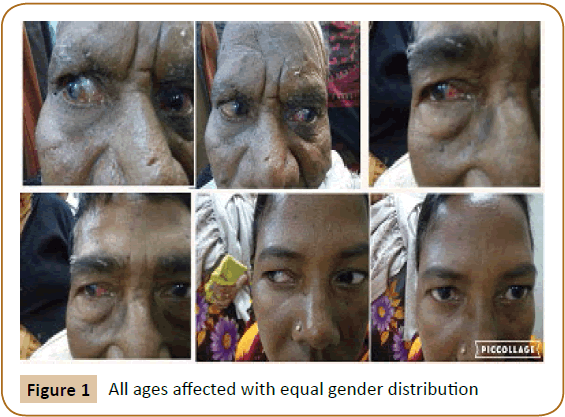 jusurgery-ages-equal-gender