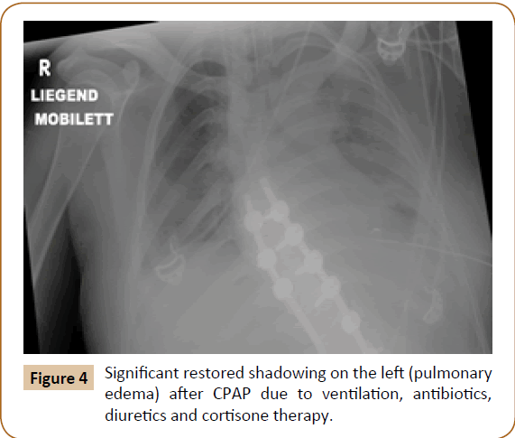 jusurgery-cortisone-therapy