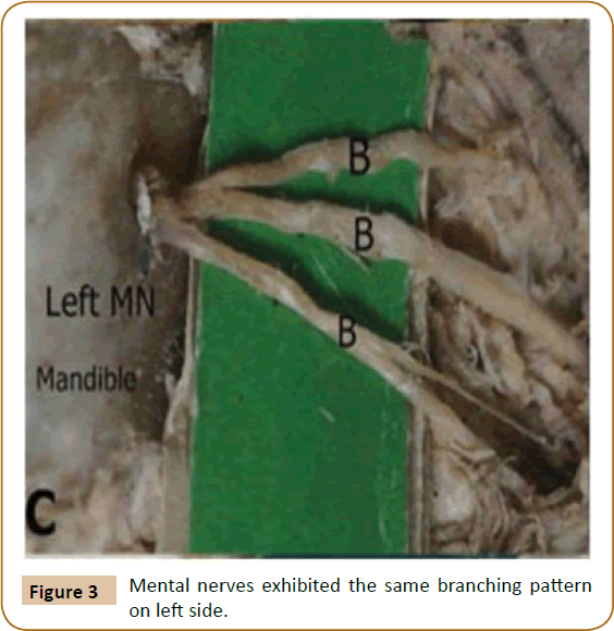 jusurgery-left-side