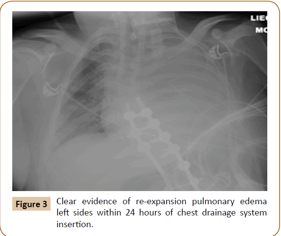 jusurgery-left-sides