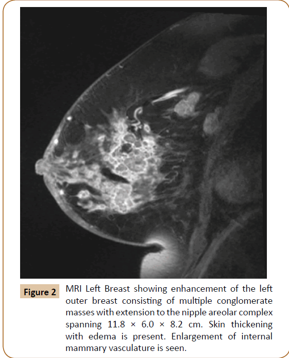 jusurgery-mammary-vasculature